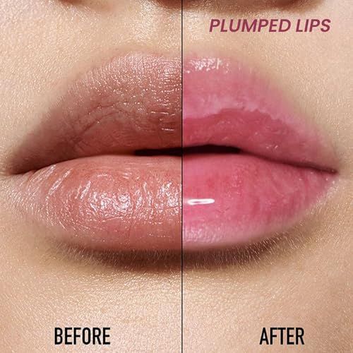 Shopaarel Little Flower Lip Gloss, Lip Gloss, Infused with Real Flower Seed Oil and Fruit Oils, Floral Fragrance, Glossy finish, Long-Lasting, Non-Sticky, Fuller & Plump Lips-8 Gm, Bubble