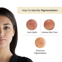 Vedix Face Serum, Customised Ayurvedic Avas Spot Correcting Face Serum for Dark Spots & Pigmentation With Vitamin A + Vitamin C + Onion + Lodhra + Bakuchi - 20 ml