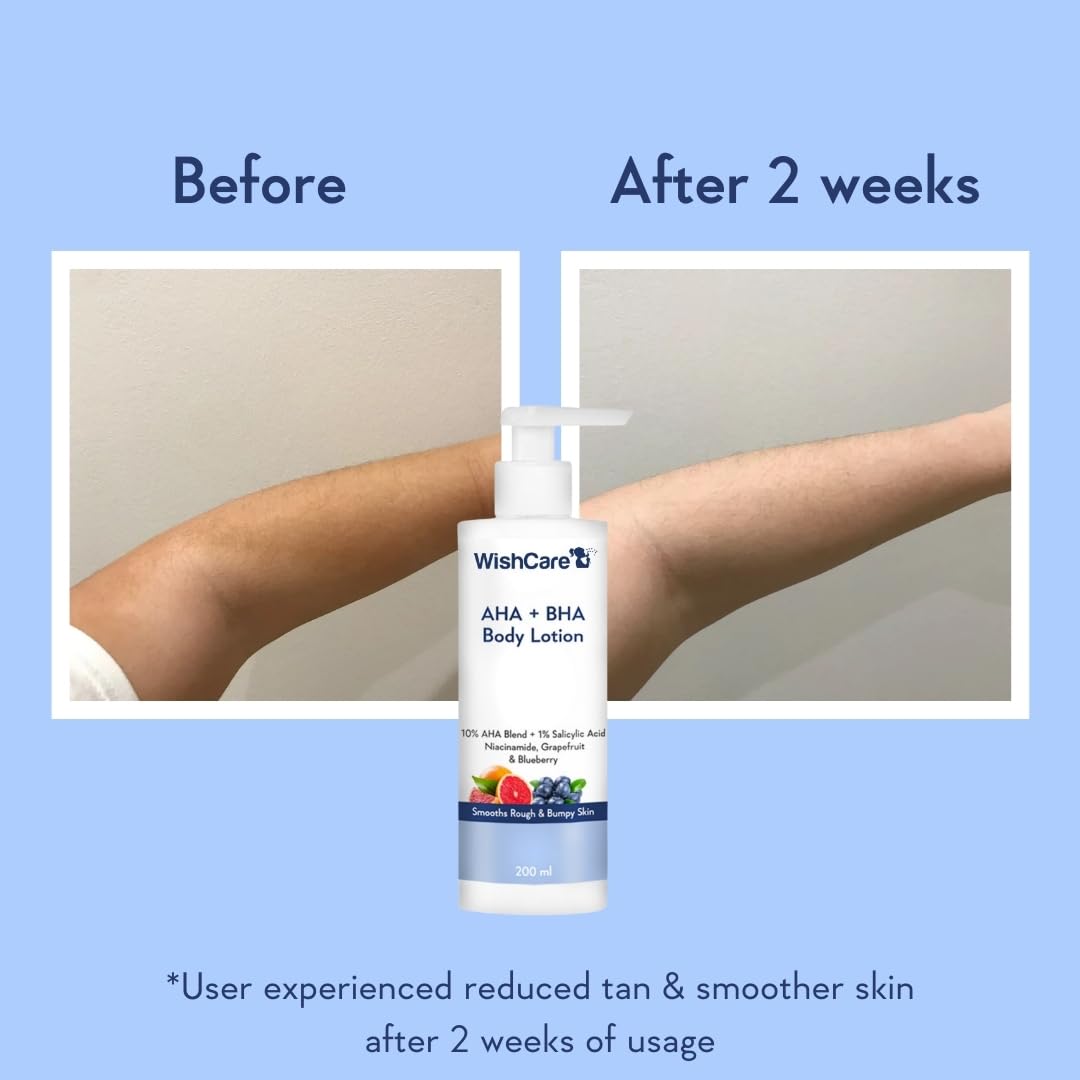 WishCare 10% AHA + 1% BHA Body Lotion for Men & Women - Body lotion for dry skin - Detans, Smooths Rough & Bumpy Skin 200ml