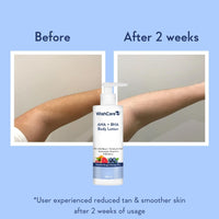 WishCare 10% AHA + 1% BHA Body Lotion for Men & Women - Body lotion for dry skin - Detans, Smooths Rough & Bumpy Skin 200ml