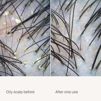 Ravel Anti-Dandruff Hair Serum for Scalp | Eliminates Dandruff & Itchiness | With 2% Dandelix Pro & 1.5% Defensescalp | Soothes & Balances Scalp | Dandruff Remover | For Men & Women | 100ml