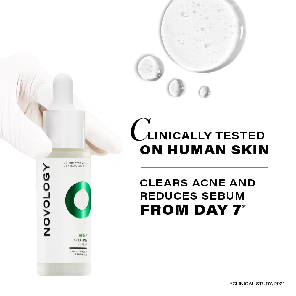 Novology Acne Clearing Serum with Thymol and Terpineol | Face Serum For Acne, Whiteheads, Blackheads | Non-sticky, Non-Irritating, Non-Comedogenic| For Oily, Acne Prone Skin | 28 ML