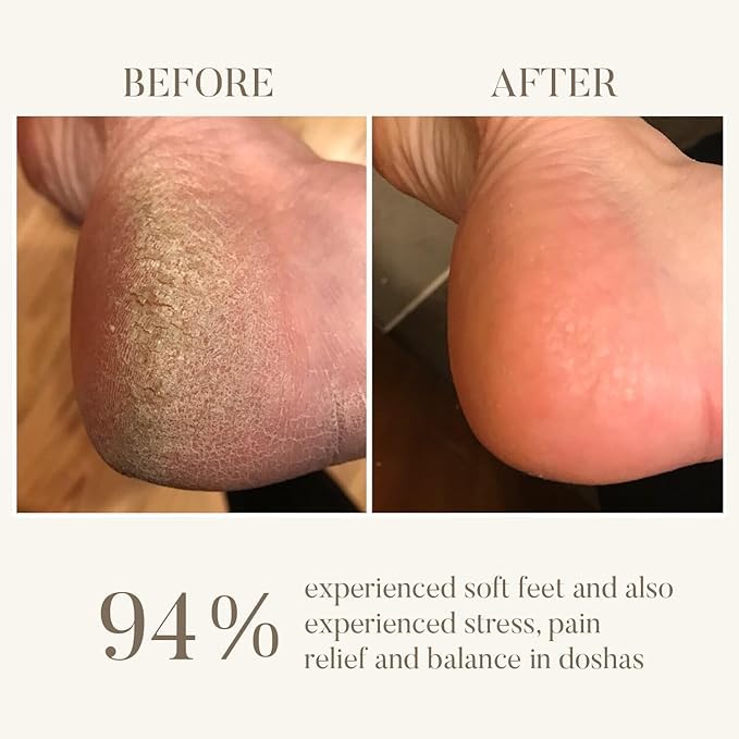 Ohria Ayurveda Amrit Ras Foot Balm | Relaxing, Softening, & Healing Foot Care | Hydrates & Softens Cracked Heels | Infused with Sesame, Almond, Cow’s Ghee & Essential Oils for Relaxation | All Skin Types| For Men & Women- 25g