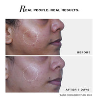 Novology Acne Deep Clearing Cleanser with Thymol+Terpineol| Face Wash for Acne,Whiteheads,Blackheads| Gentle, Non-Drying Formula, Suitable for Sensitive skin| 150ml