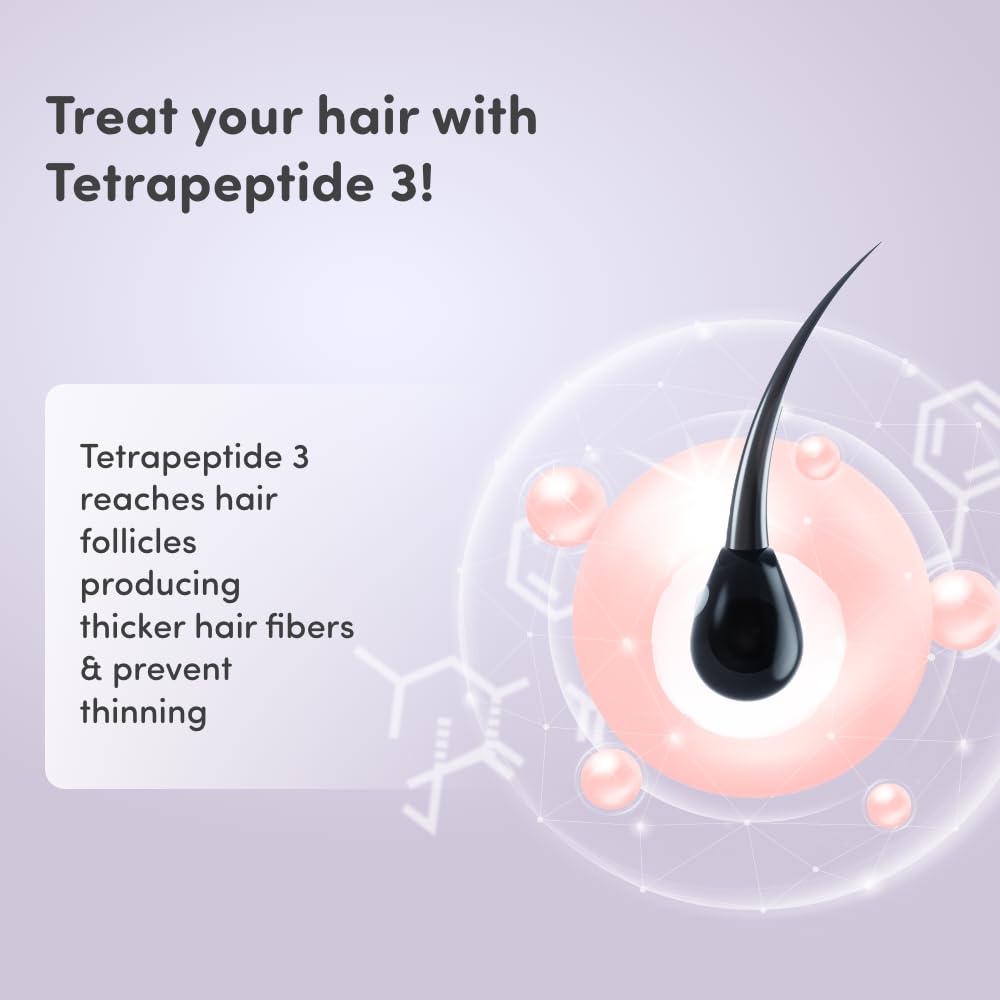 Mylo Pre & Post Pregnancy Hairfall Shampoo with Onion - 200 ml