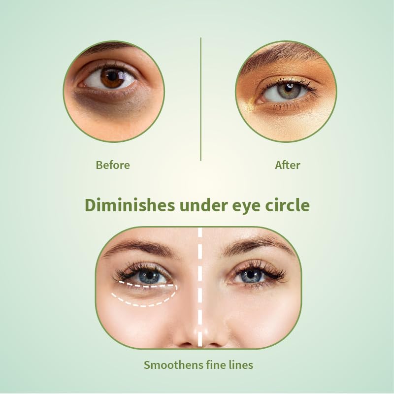 Ayouthveda Hemp Seed Under Eye Gel with Cooling Massage Roller|For Puffy Eyes, Dark Circles, Wrinkles & Fine Lines|With Hemp Seed Oil, Almond oil & Coffee| (Pack of 1;15ml)