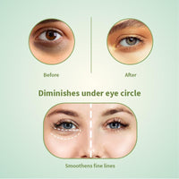 Ayouthveda Hemp Seed Under Eye Gel with Cooling Massage Roller|For Puffy Eyes, Dark Circles, Wrinkles & Fine Lines|With Hemp Seed Oil, Almond oil & Coffee| (Pack of 1;15ml)