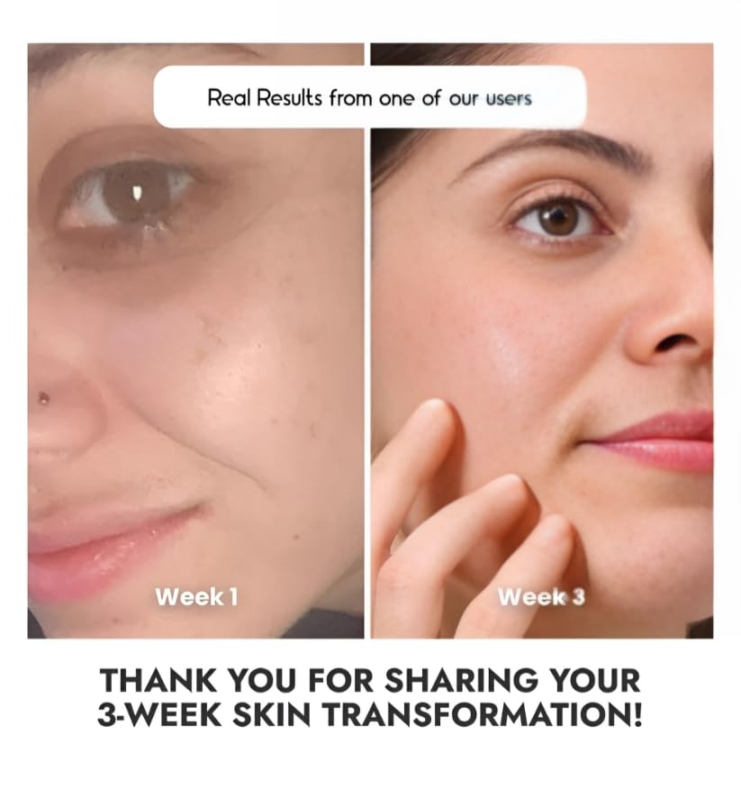 Cos-IQ 23% Vitamin C Face Serum for Glowing Skin (30 Days Pack) | Advanced Molecular Skincare Technology | Highly Stable, Non Irritating, Non Sticky| Brightening Vit C Formula For Men and Women | 30ml