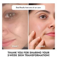 Cos-IQ 23% Vitamin C Face Serum for Glowing Skin (30 Days Pack) | Advanced Molecular Skincare Technology | Highly Stable, Non Irritating, Non Sticky| Brightening Vit C Formula For Men and Women | 30ml