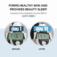 SKIN1004 Madagascar Centella Hyalu-Cica Cream Sleeping Pack | Made With Pure Centella | Suitable For All Skin Types | 100Ml