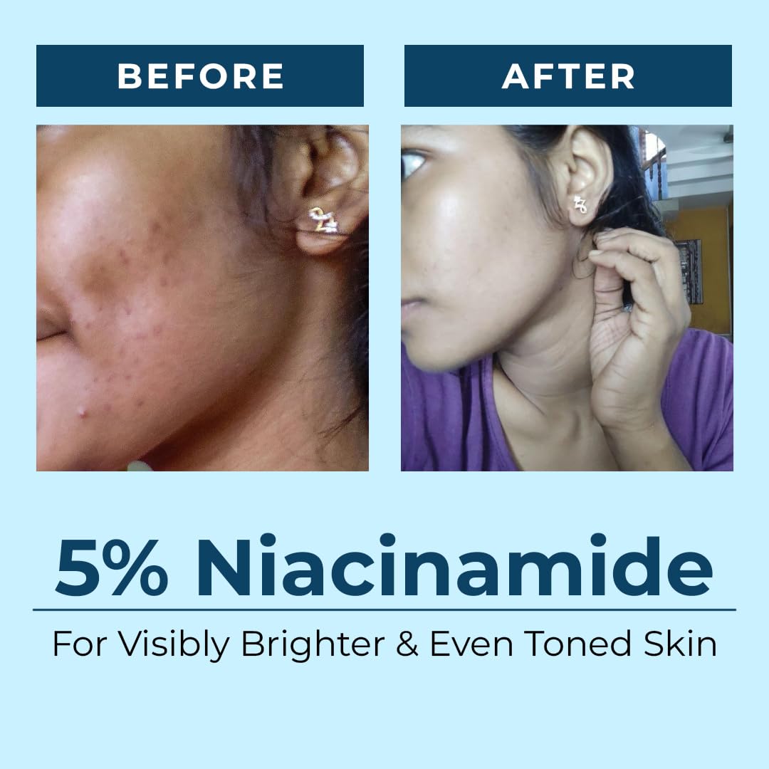 AQUAVE Marine Hyper Pigmentation Face Serum | 1% Alpha Arbutin | 3% Vitamin C | 1% Kojic Acid | 5% Niacinamide | Fades Dark Spots | Anti-Ageing | Brightens Skin | Seaboost™ Tech | Results in 30 Days