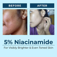 AQUAVE Marine Hyper Pigmentation Face Serum | 1% Alpha Arbutin | 3% Vitamin C | 1% Kojic Acid | 5% Niacinamide | Fades Dark Spots | Anti-Ageing | Brightens Skin | Seaboost™ Tech | Results in 30 Days