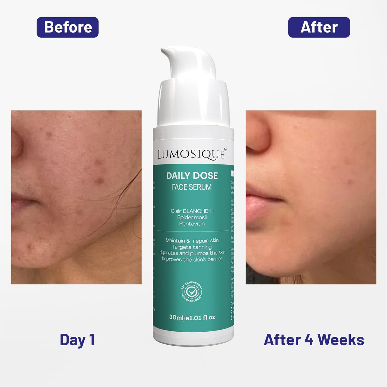 LUMOSIQUE® Daily Dose Face Serum for Maintain & Repair Skin, Target Tanning, Hydrates & Plump The Skin, Improve Skin Barrier | For Use in AM & PM | Men & Women| 30ml