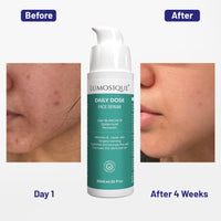 LUMOSIQUE® Daily Dose Face Serum for Maintain & Repair Skin, Target Tanning, Hydrates & Plump The Skin, Improve Skin Barrier | For Use in AM & PM | Men & Women| 30ml
