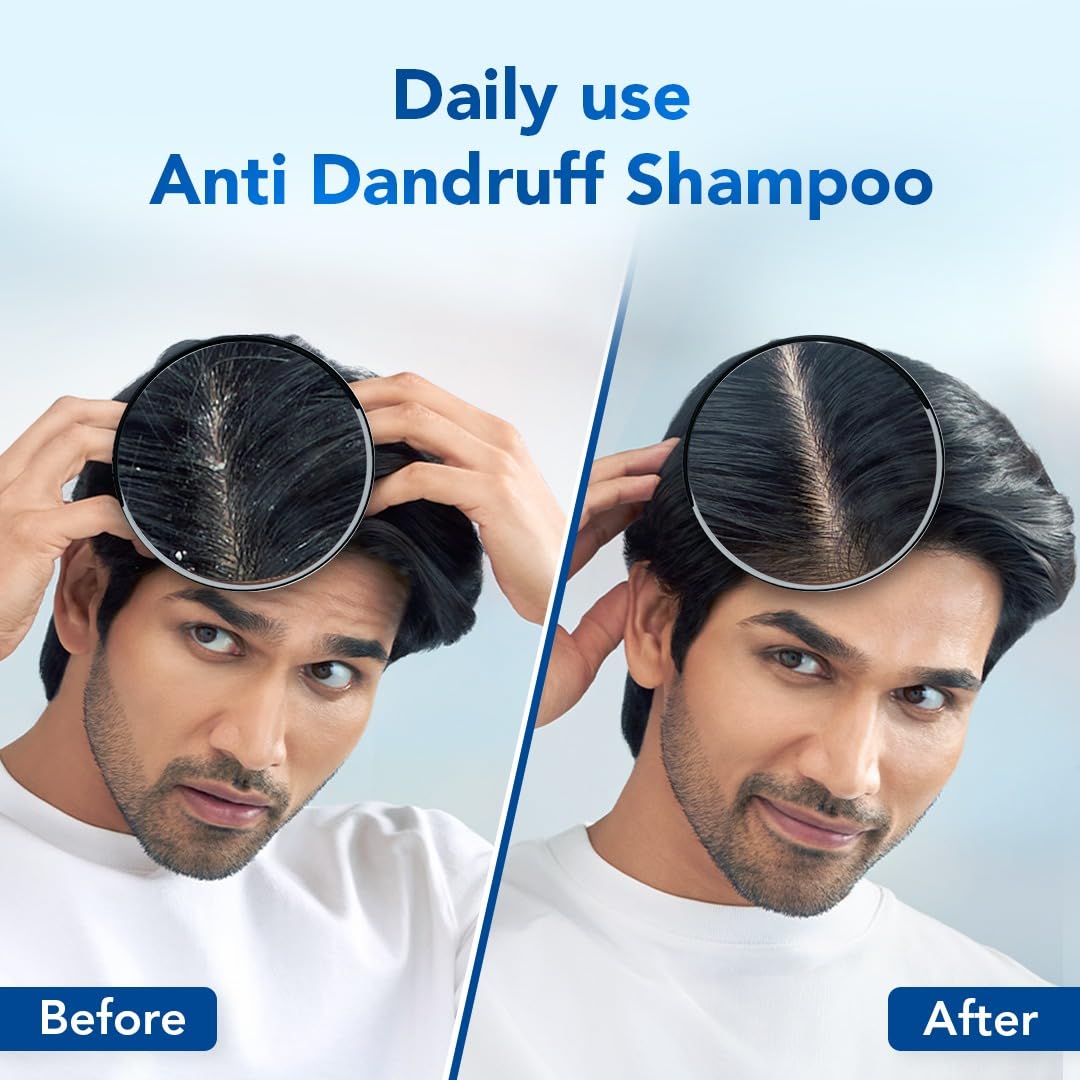 Scalpe Pro Anti dandruff Shampoo 200ml,Scalpe Pro Daily Anti-Dandruff Shampoo | Removes Dandruff From Source | Helps With Itching, Irritat