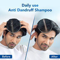 Scalpe Pro Anti dandruff Shampoo 200ml