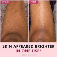 mCaffeine Brightening Raspberry Body Scrub | Tan Removal | AHAs - Lactic & Glycolic Acid, Niacinamide | Vitamin C Rich for Brighter, Soft Skin | Remove Dry, Dead Skin | Fruity Berries Aroma - 175g