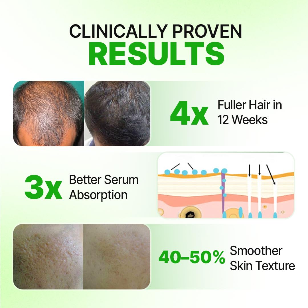 Sotrue Epifine Derma Roller 0.5mm with Sanitizer | 540 Medical Grade Stainless Steel Needles | Derma Roller for Hair Growth & Thickening, Repair Damages and Activates Hair Follicles (Green)