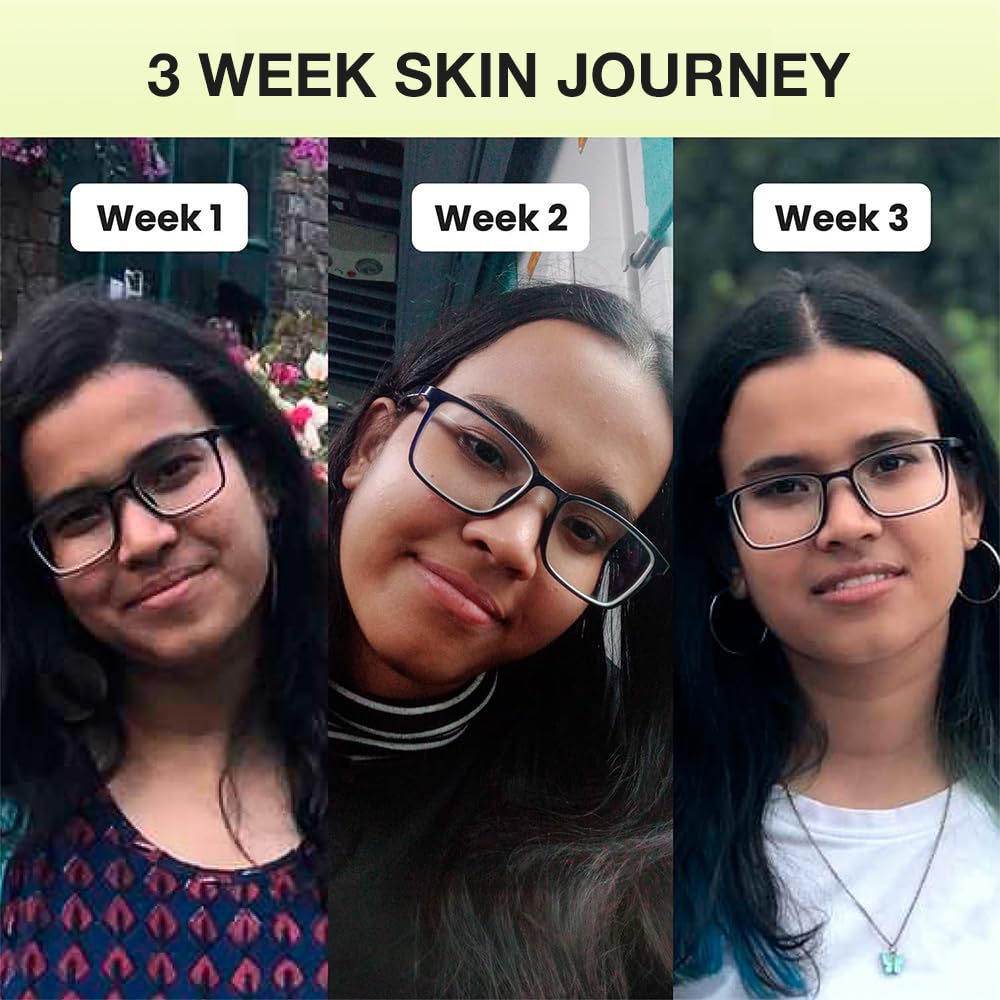 Cos-IQ 20% Niacinamide Face Serum For Clear Glowing Skin, Bright Skin, Reduces Dullness, Hydrates & Repairs Skin with Vit B3 & Hyaluronic Acid for Targets Acne Marks | For Women & Men | 30ml