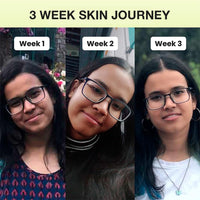 Cos-IQ Niacinamide Vitamin B3-20% Serum | 30 ml, Pack of 2