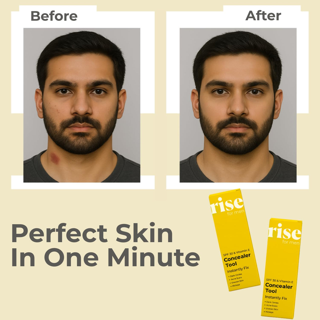 Rise for Men Concealer Tool | Covers Spots, Dark Circles, Acne Scars, & Hickeys Instantly | SPF 30 & Vitamin E | Available in 4 Shades (Tan)