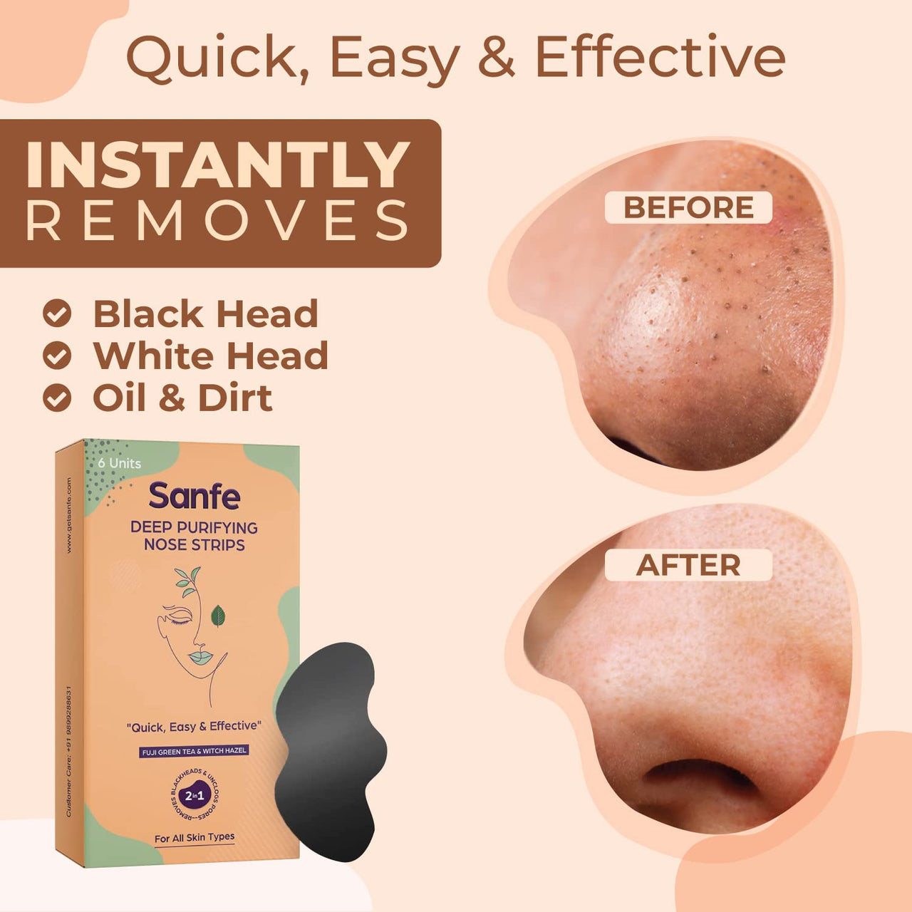 Sanfe Intimate Lightening Serum - 50g & Sanfe Deep Purifying Nose Strips for Women - Pack of 6 with Fuji Green Tea & Witch Hazel extracts