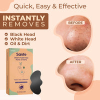 Sanfe Intimate Lightening Serum - 50g & Sanfe Deep Purifying Nose Strips for Women - Pack of 6 with Fuji Green Tea & Witch Hazel extracts