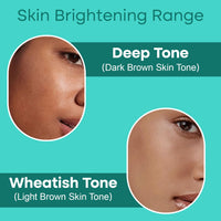 iVedic AyurScience Skin Brightening Serum for Women and Men (1% Hydrogen Aquaporin, 2% Squalene & Betaine 2%) Removes Tan For Even Skin Tone - Only Suitable for Dry Skin - 30 ml