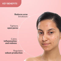 Fixderma 2% Salicylic Acid Serum for Anti Acne & Spot Treatment with 5% Azelaic Acid & 4% Mandelic Acid | Anti Acne Face Serum | Face Serum for Men & Women - 30g…