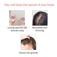 Vedix Vikleda Shampoo & Vithan Hair Growth Serum Combo For Women & Men | For Dry Hair & Hair Growth | 100ml + 40 ml