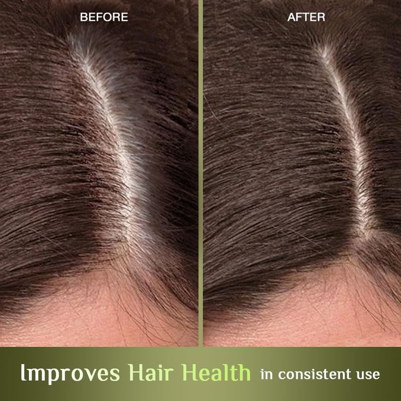 Richfeel Hair Nourisher Oil| For Hair Fall Control | Hair Growth Treatment | Trichologist Developed Formula | High Concentration |10 ml