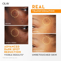 Olay Vitamin C Kit for 2X Glow | Vitamin C Cream with Free Cleanser l Even Glow and Smooth Texturee | With Niacinamide l Normal, Oily, Dry & Combination Skin l Parabens & Sulphate free | Pack of 2