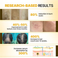 Sotrue Professional Derma Roller For Hair Growth 1 mm with 192 Stainless Steel Needles | Repairs Damaged Hair, Activates Hair Follicles | For Hair Fall & Hair Thickening | Reduces Acne Scars | Safe & Effective To Use