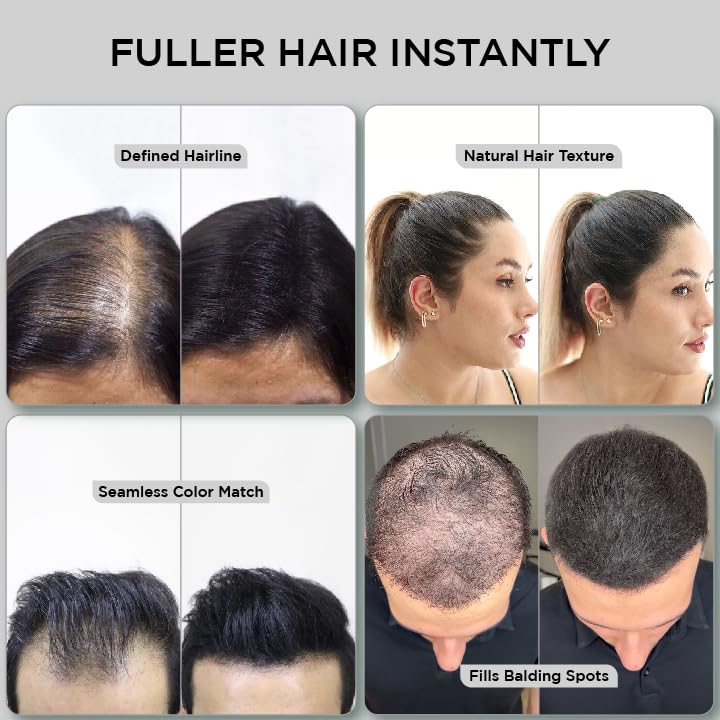 THICK FIBER - Fibers for Thinning Hair & Bald spots (BLACK, Pack of 3) - 25g Bottle - Conceals Hair Loss in Seconds For Women & Men
