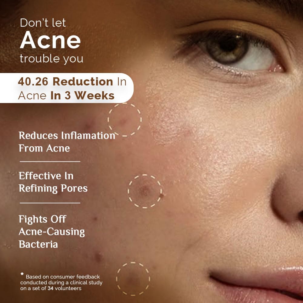 Richfeel Calendula Anti Acne Brightening Soap | Bathing Soaps | Bath Soap for Men & Women | Soaps for Bath | TFM Grade 1 Soap | For Oily Skin | Fades Dark Spots | - 75Gm X 4 (B3G1) Pack of 4