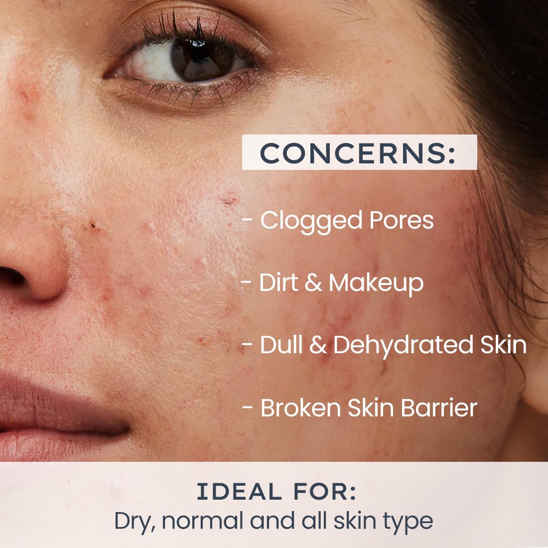 Hyphen Moisturizing Creamy Face Wash for Dry & Sensitive Skin | 2% Ceramides & Polyglutamic Acid | Barrier Repair, Hydration & Gentle Cleansing | Facewash, Oily, Dry, All Skin Types| Face Cleanser for winters | Skin Care Products | Face Care Daily Cleanse