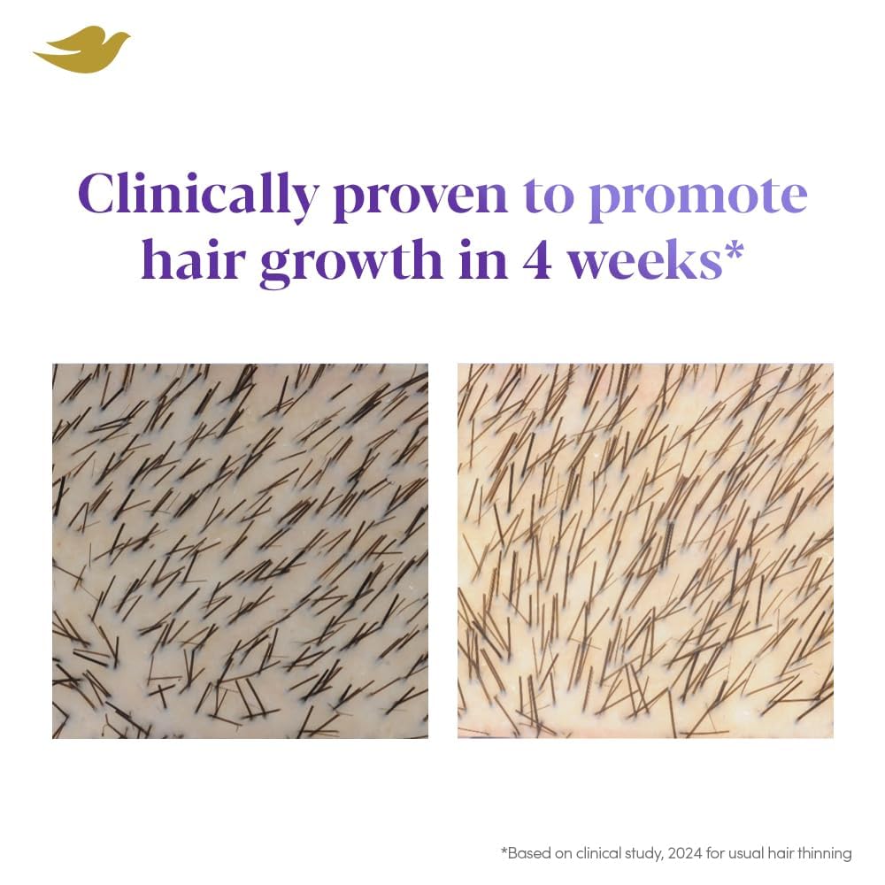 Dove Scalp + Hair Therapy Density Boost Revitalizing Scalp Serum with active ingredients 2.5% Niacinamide and 1.5% Zinc-peptides for visibly denser hair growth