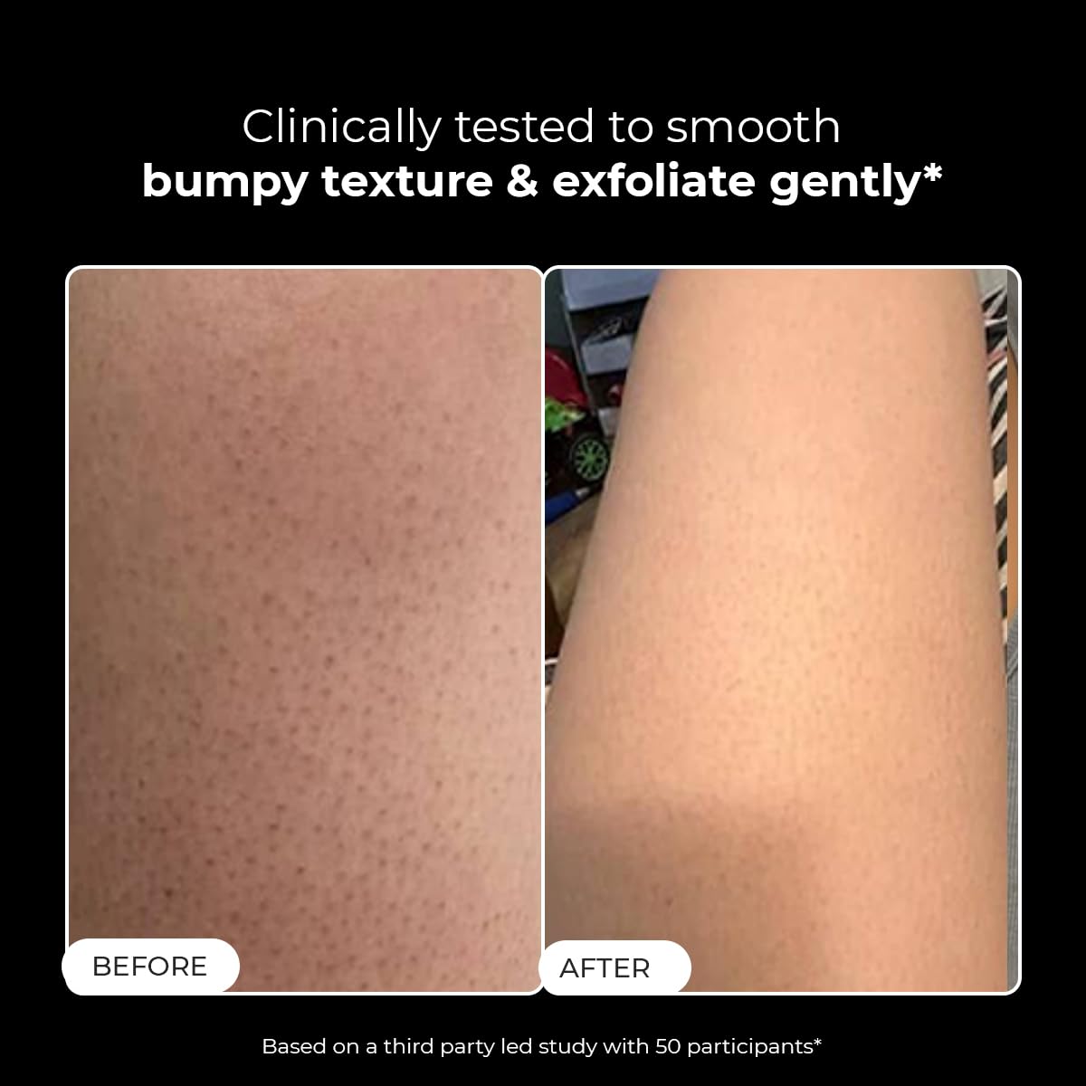 Conscious Chemist® Skin Reset Exfoliating Bodywash | 300ml | 1% Salicylic Acid Shower Gel with Volcanic Sand & Lactic Acid | Exfoliates, Clears Body Acne, Smooths Bumpy Skin | For Keratosis Pilaris & Strawberry Legs | Men & Women, Suitable for All Skin Ty