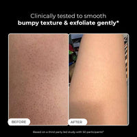 Conscious Chemist® Skin Reset Exfoliating Bodywash | 300ml | 1% Salicylic Acid Shower Gel with Volcanic Sand & Lactic Acid | Exfoliates, Clears Body Acne, Smooths Bumpy Skin | For Keratosis Pilaris & Strawberry Legs | Men & Women, Suitable for All Skin Ty