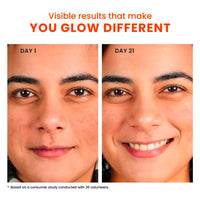 Foxtale 10% Vitamin C + Glutathione Complex Serum, Brightens skin in 3 days, Fades melasma & dark spots, Evens Skin tone, Gentle & Non-irritating, For All Skin types, Men & Women