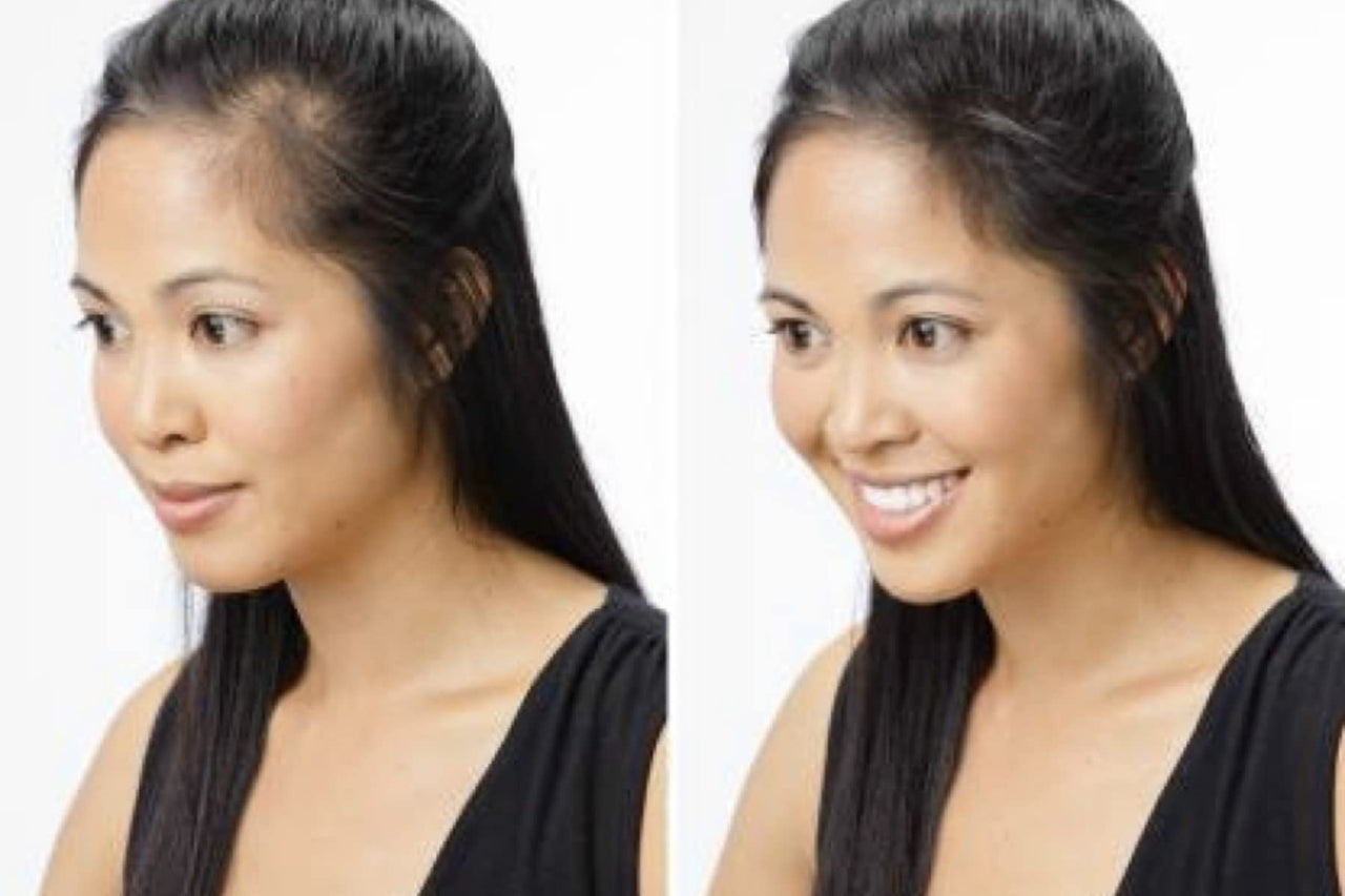 Shills Professional Black Hair Building Fibers Men,Women fibers for Hair loss coverage (net 25g)