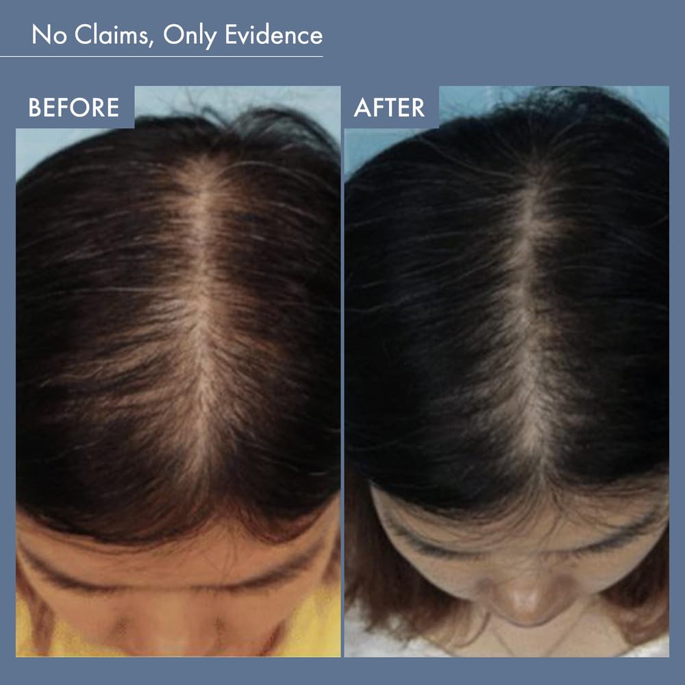 ThriveCo Rosemary Hair Shampoo For Voluminous Hair | Densifying & Stimulating Hair Growth | Promotes Hair Strength With Hyaplex™, Pea Peptide & Caffeine for Men & Women (250 ml)