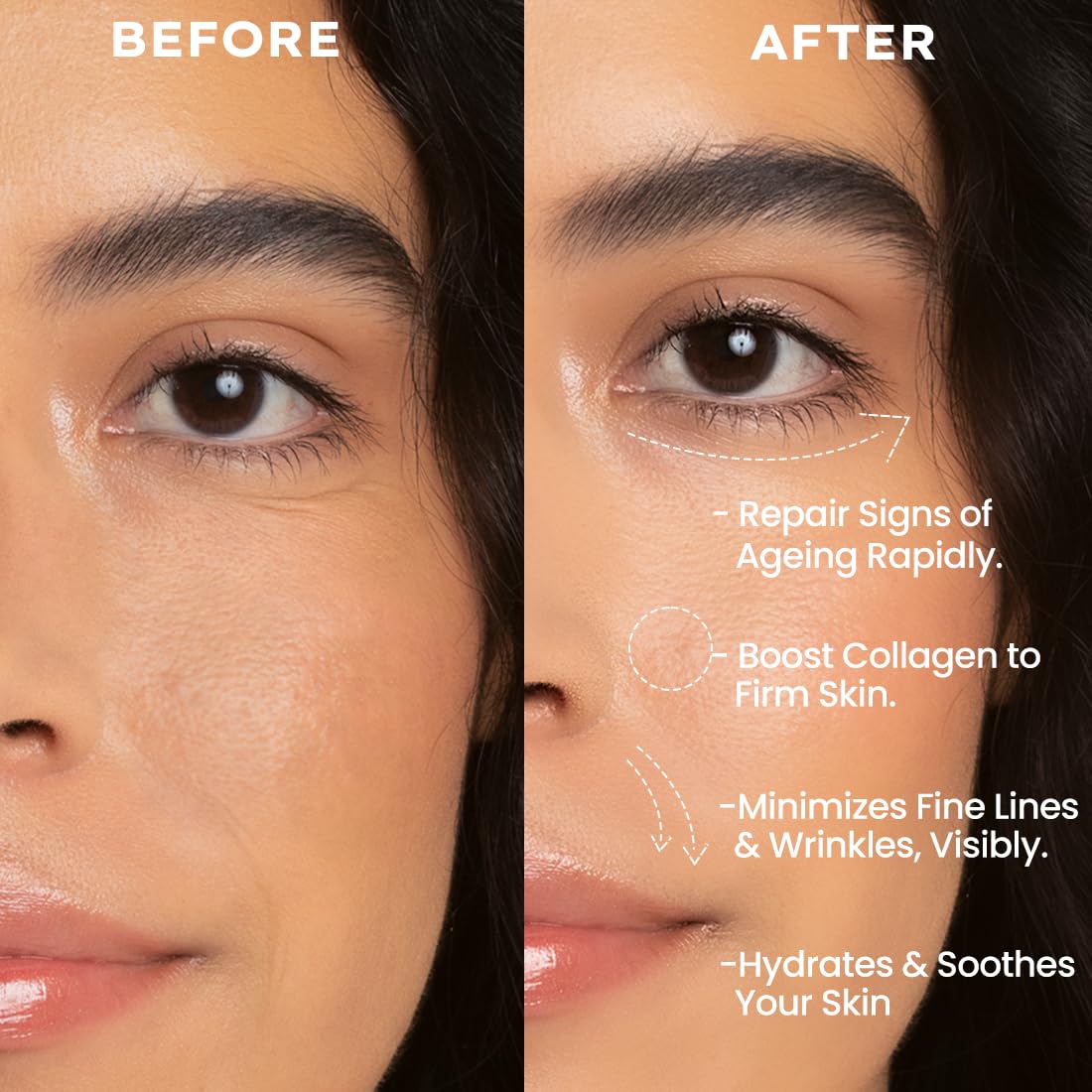 Hyphen 0.1% Retinal Reset Serum Pro | 30% More Effective than Retinol Serum| Advanced Anti Ageing Face Serum | Reduces Fine Lines & Wrinkles | Serum for Women and Men | Boosts Collagen, Hydrates & Soothes Skin-30 ml