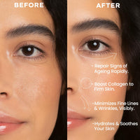 Hyphen 0.1% Retinal Reset Serum Pro | 30% More Effective than Retinol Serum| Advanced Anti Ageing Face Serum | Reduces Fine Lines & Wrinkles | Serum for Women and Men | Boosts Collagen, Hydrates & Soothes Skin-30 ml