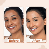 The Derma Co. 1% Hyaluronic Hydrating High Coverage Foundation With SPF 40 PA+++ for 12 Hour Long Stay & 12 Hour Oil Control | For All Skin Types & Even Skin - 18ml (03 Natural, 18ML)