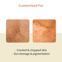 Vedix Customized Face Pack - Rejat Brightening Clay Mask For Tanned Skin With Masoor + Peppermint + Kaolin