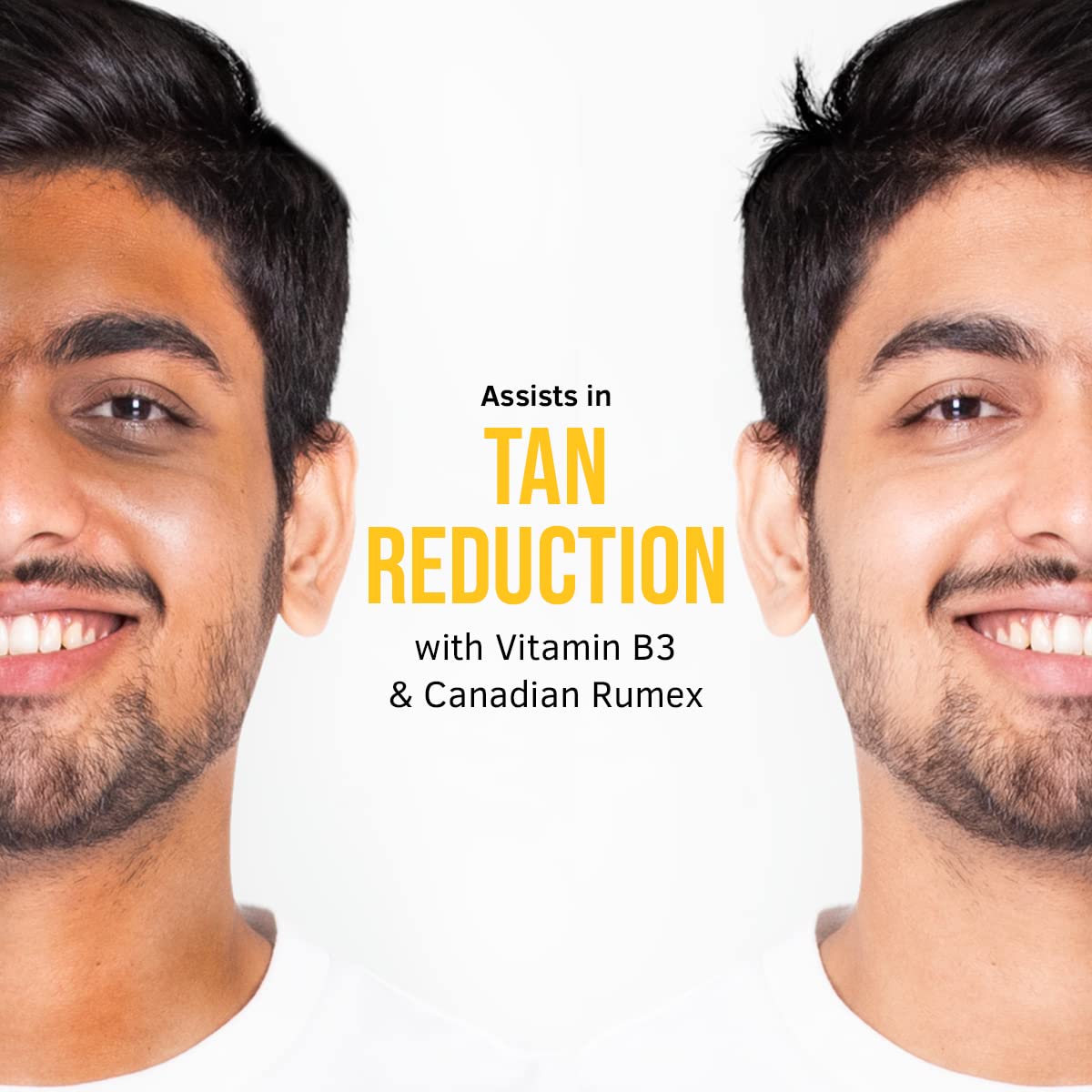 Ustraa Quick Action De-Tan Facial Kit for Men - Set of 4 | De-Tan Face Scrub - 100g | De-Tan Face Mask Oily Skin - 125g | 20% Vitamin C Face Serum - 30ml | De-Tan Cream - 50g | Effective Tan Removal