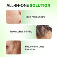 Sotrue Epifine Derma Roller 0.5mm with Sanitizer | 540 Medical Grade Stainless Steel Needles | Derma Roller for Hair Growth & Thickening, Repair Damages and Activates Hair Follicles (Green)