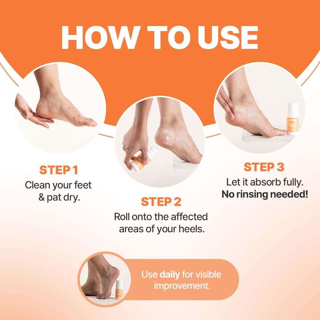 Sotrue 20% Urea Foot Cream Roll-On for Dry & Cracked Heels | 2% Lactic Acid, Olive Oil & Vitamin E | Helps Repair and Moisturise Cracked Heels | Dermatologically Tested | 50ml