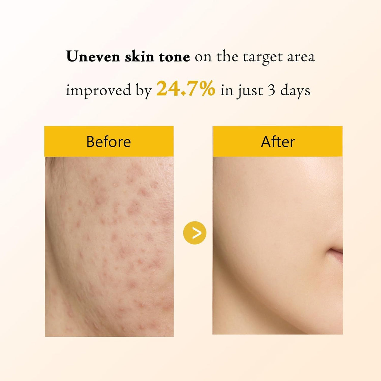 Kojic Acid Turmeric Overnight Wrapping Peel Off Mask – Brightens & Defends Against Skin Stress for a Clear, Glowing Complexion, Korean Skincare Facial Mask, 2.65 fl. oz.